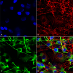 SMC-429_GluN2A-NR2A_Antibody_N327-95_ICC-IF_Human_Neuroblastoma-cells-SH-SY5Y-Composite-1.png