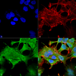 SMC-430-Notch1-Antibody-N253-32-ICC-IF-Human-Neuroblastoma-cell-line-SK-N-BE-60X-Composite-1.png