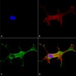 SMC-430_Notch1_Antibody_N253-32_ICC-IF_Human_Neuroblastoma-cells-SH-SY5Y-Composite-1.png