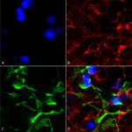 SMC-431_SUR2A_Antibody_N319A-14_ICC-IF_Human_Neuroblastoma-cells-SH-SY5Y-Composite-1.png