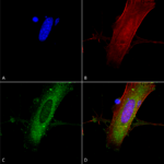 SMC-434_GluN2A-NR2A_Antibody_N327A-38_ICC-IF_Human_Neuroblastoma-cells-SH-SY5Y-Composite-1.png