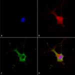 SMC-435_Alpha-2C-Adrenergic-Receptor_Antibody_N330A-80_ICC-IF_Human_Neuroblastoma-cells-SH-SY5Y-Composite-1.png