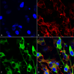 SMC-439_Versican_Antibody_N351-23_ICC-IF_Human_Neuroblastoma-cells-SH-SY5Y-Composite-1.png