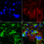 SMC-440_GluA1-GluR1_Antibody_N355-1_ICC-IF_Human_Neuroblastoma-cells-SH-SY5Y-Composite-1.png