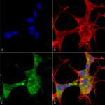 SMC-441_GFAP_Antibody_N206A-8_ICC-IF_Human_Neuroblastoma-cells-SH-SY5Y-Composite-1.png