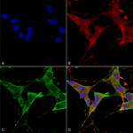 SMC-443_LAR-PTPRF_Antibody_N165-38_ICC-IF_Human_Neuroblastoma-cells-SH-SY5Y-Composite-1.png