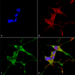 SMC-445_LRRK2-Dardarin_Antibody_N231B-34_ICC-IF_Human_Neuroblastoma-cells-SH-SY5Y-Composite-1.png