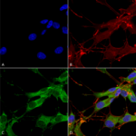 SMC-446_LRRK2-Dardarin_Antibody_N138-6_ICC-IF_Human_Neuroblastoma-cells-SH-SY5Y-Composite-1.png