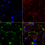 SMC-447_ATF4_Antibody_N360A-24_ICC-IF_Human_Neuroblastoma-cells-SH-SY5Y-Composite-1.png