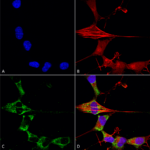 SMC-448_FGFA-FHFA-pan_Antibody_N235-22_ICC-IF_Human_Neuroblastoma-cells-SH-SY5Y-Composite-1.png