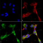 SMC-450_PINK1_Antibody_N4-15_ICC-IF_Human_Neuroblastoma-cells-SH-SY5Y-Composite-1.png