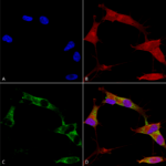 SMC-454_Protocadherin-Gamma-pan_Antibody_N159-5_ICC-IF_Human_Neuroblastoma-cells-SH-SY5Y-Composite-1.png