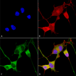 SMC-455_Ataxin-1_Antibody_N76-8_ICC-IF_Human_Neuroblastoma-cells-SH-SY5Y-Composite-1.png