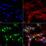 SMC-456_VDAC1_Antibody_N152B-23_ICC-IF_Human_Neuroblastoma-cells-SH-SY5Y-Composite-1.png