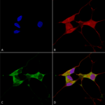 SMC-457_Mitofusin-2_Antibody_N153-5_ICC-IF_Human_Neuroblastoma-cells-SH-SY5Y-Composite-1.png