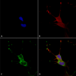 SMC-461_LGI1_Antibody_N283-7_ICC-IF_Human_Neuroblastoma-cells-SH-SY5Y-Composite-1.png