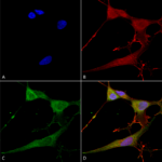 SMC-462_NrCAM_Antibody_N364-51_ICC-IF_Human_Neuroblastoma-cells-SH-SY5Y-Composite-1.png