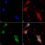 SMC-463_Neuroligin-1_Antibody_N97A-31_ICC-IF_Human_Neuroblastoma-cells-SH-SY5Y-Composite-1.png