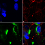 SMC-467_QKI-pan_Antibody_N147-6_ICC-IF_Human_Neuroblastoma-cells-SH-SY5Y-Composite-1.png