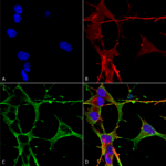 SMC-471_Neuroligin-3_Antibody_N110-29_ICC-IF_Human_Neuroblastoma-cells-SH-SY5Y-Composite-1.png