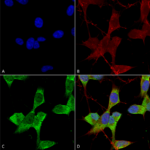 SMC-473_TASK1-Potassium-Channel_Antibody_N374-48_ICC-IF_Human_Neuroblastoma-cells-SH-SY5Y-Composite-1.png