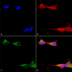 SMC-475_Ataxin-1_Antibody_N65-37_ICC-IF_Human_Neuroblastoma-cells-SH-SY5Y-Composite-1.png