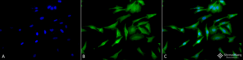<p>Immunocytochemistry/Immunofluorescence analysis using Rat Anti-HSF1 Monoclonal Antibody, Clone 10H4 (SMC-476). Tissue: Heat Shocked cervical cancer cells (HeLa). Species: Human. Fixation: 2% Formaldehyde for 20 min at RT. Primary Antibody: Rat Anti-HSF1 Monoclonal Antibody (SMC-476) at 1:100 for 12 hours at 4°C. Secondary Antibody: FITC Goat Anti-Rat (green) at 1:200 for 2 hours at RT. Counterstain: DAPI (blue) nuclear stain at 1:40000 for 2 hours at RT. Localization: Cytoplasm. Localizes to the nucleus upon activation. Magnification: 20x. (A) DAPI (blue) nuclear stain. (B) Anti-HSF1 Antibody. (C) Composite. Heat Shocked at 42°C for 1h.</p>
