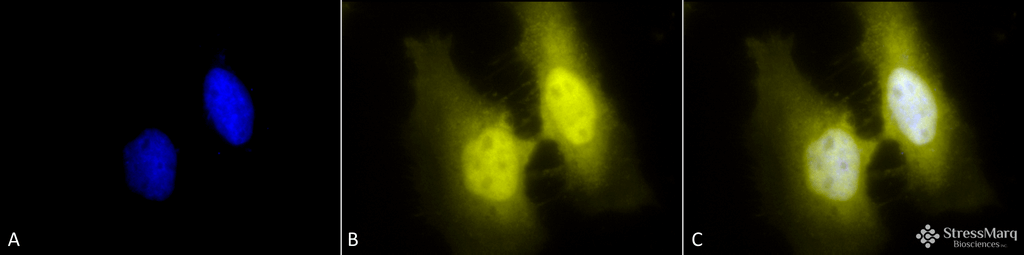 <p>Immunocytochemistry/Immunofluorescence analysis using Rat Anti-HSF1 Monoclonal Antibody, Clone 4B4 (SMC-477). Tissue: Heat Shocked cervical cancer cells (HeLa). Species: Human. Fixation: 2% Formaldehyde for 20 min at RT. Primary Antibody: Rat Anti-HSF1 Monoclonal Antibody (SMC-477) at 1:100 for 12 hours at 4°C. Secondary Antibody: R-PE Goat Anti-Rat (yellow) at 1:200 for 2 hours at RT. Counterstain: DAPI (blue) nuclear stain at 1:40000 for 2 hours at RT. Localization: Cytoplasm. Localizes to the nucleus upon activation. Magnification: 100x. (A) DAPI (blue) nuclear stain. (B) Anti-HSF1 Antibody. (C) Composite. Heat Shocked at 42°C for 1h.</p>
