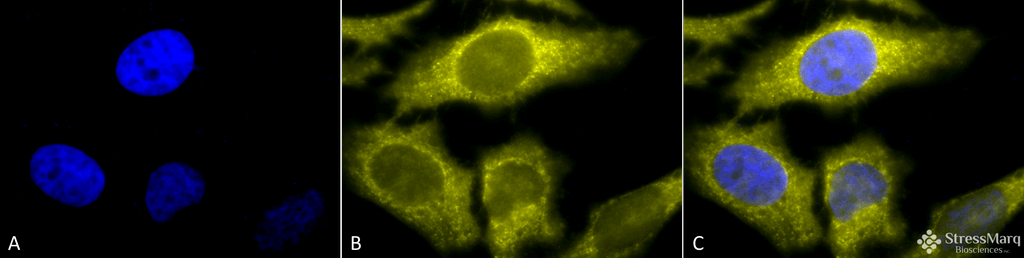 <p>Immunocytochemistry/Immunofluorescence analysis using Rat Anti-TCP1-alpha Monoclonal Antibody, Clone 91a (SMC-479). Tissue: Heat Shocked cervical cancer cells (HeLa). Species: Human. Fixation: 2% Formaldehyde for 20 min at RT. Primary Antibody: Rat Anti-TCP1-alpha Monoclonal Antibody (SMC-479) at 1:100 for 12 hours at 4°C. Secondary Antibody: R-PE Goat Anti-Rat (yellow) at 1:200 for 2 hours at RT. Counterstain: DAPI (blue) nuclear stain at 1:40000 for 2 hours at RT. Localization: Cytoplasm. Centrosome. Magnification: 100x. (A) DAPI (blue) nuclear stain. (B) Anti-TCP1-alpha Antibody. (C) Composite. Heat Shocked at 42°C for 1h.</p>
