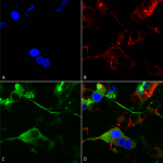SMC-486_GABA-A-Receptor-Alpha-2_Antibody_N399-19_ICC-IF_Human_Neuroblastoma-cells-SH-SY5Y-Composite-1.png