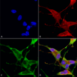 SMC-487_Ankyrin-R_Antibody_N388A-10_ICC-IF_Human_Neuroblastoma-cells-SH-SY5Y-Composite-1.png