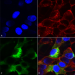 SMC-490_Nav-beta3_Antibody_N396-29_ICC-IF_Human_Neuroblastoma-cells-SH-SY5Y-Composite-1.png