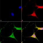 SMC-491_Kir61_Antibody_N366-60_ICC-IF_Human_Neuroblastoma-cells-SH-SY5Y-Composite-1.png