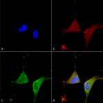 SMC-494_GABA-A-Receptor-Alpha-5_Antibody_N415-24_ICC-IF_Human_Neuroblastoma-cells-SH-SY5Y-Composite-1.png
