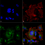 SMC-495_NPAS4_Antibody_N408-79_ICC-IF_Human_Neuroblastoma-cell-line-SK-N-BE_60X_Composite_1.png