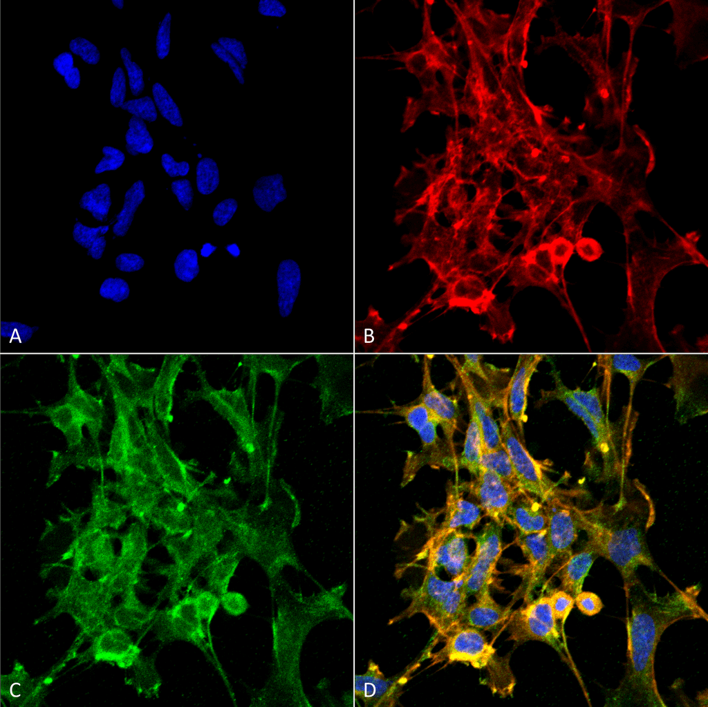 <p>Immunocytochemistry/Immunofluorescence analysis using Mouse Anti-Citrulline Monoclonal Antibody, Clone 6C2.1 (SMC-501). Tissue: Embryonic kidney epithelial cell line (HEK293). Species: Human. Fixation: 5% Formaldehyde for 5 min. Primary Antibody: Mouse Anti-Citrulline Monoclonal Antibody (SMC-501) at 1:50 for 30-60 min at RT. Secondary Antibody: Goat Anti-Mouse Alexa Fluor 488 at 1:1500 for 30-60 min at RT. Counterstain: Phalloidin Alexa Fluor 633 F-Actin stain; DAPI (blue) nuclear stain at 1:250, 1:50000 for 30-60 min at RT. Magnification: 20X (2X Zoom). (A) DAPI (blue) nuclear stain. (B) Phalloidin Alexa Fluor 633 F-Actin stain. (C) Citrulline Antibody (D) Composite. Courtesy of: Dr. Robert Burke, University of Victoria.</p>
