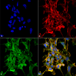 SMC-501_Citrulline_Antibody_6C21_ICC-IF_Human_Embryonic-kidney-cells-HEK293_Composite_1.png