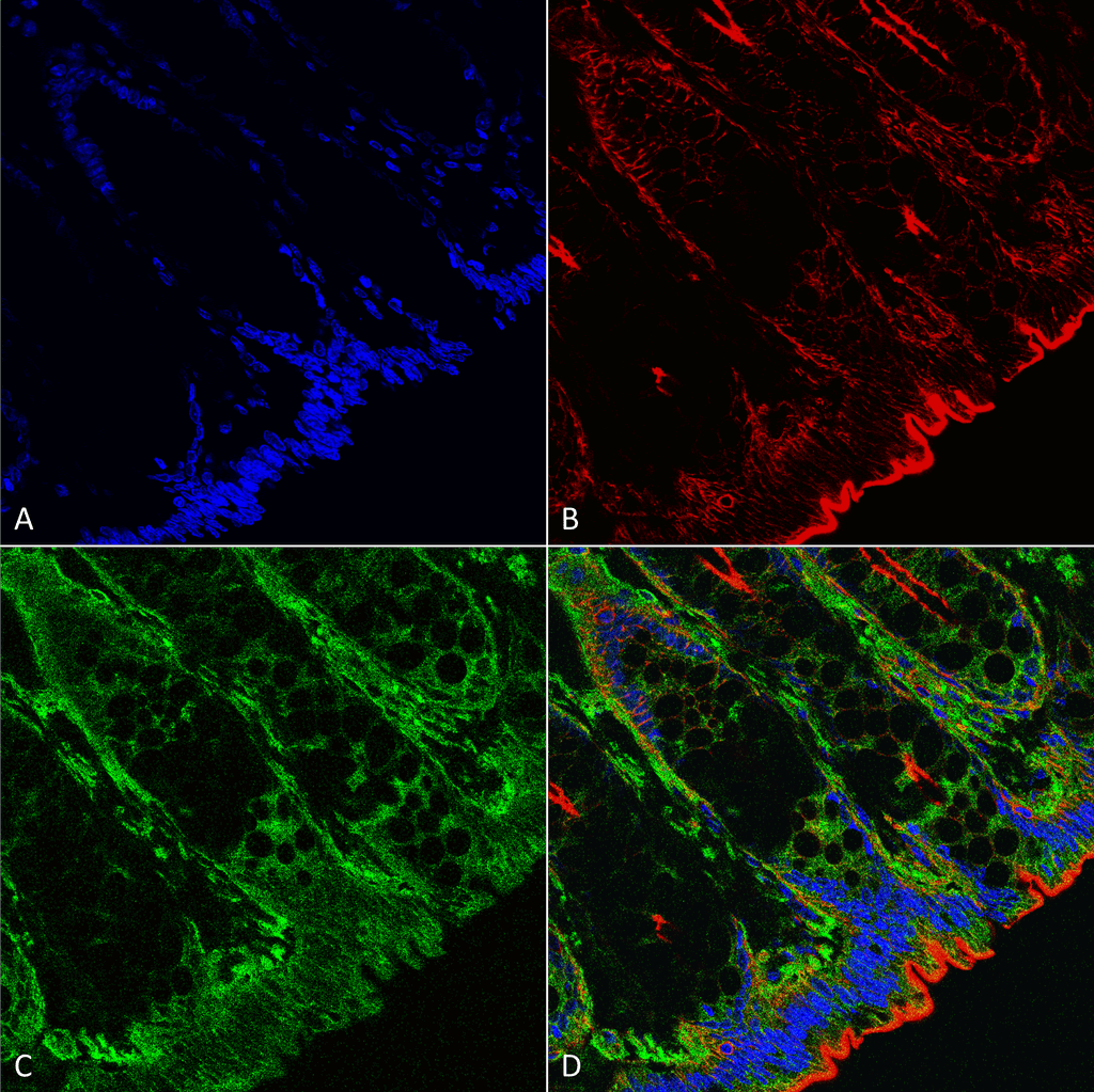 <p>Immunohistochemistry analysis using Mouse Anti-O-GlcNAc Monoclonal Antibody, Clone 9H6 (SMC-502). Tissue: colon. Species: Mouse. Fixation: Formalin fixed, paraffin embedded. Primary Antibody: Mouse Anti-O-GlcNAc Monoclonal Antibody (SMC-502) at 1:25 for 1 hour at RT. Secondary Antibody: Goat Anti-Mouse IgG: Alexa Fluor 488. Counterstain: Actin-binding Phalloidin-Alexa Fluor 633; DAPI (blue) nuclear stain. Magnification: 63X. (A) DAPI (blue) nuclear stain. (B) Citrulline Antibody (C) Composite.</p>
