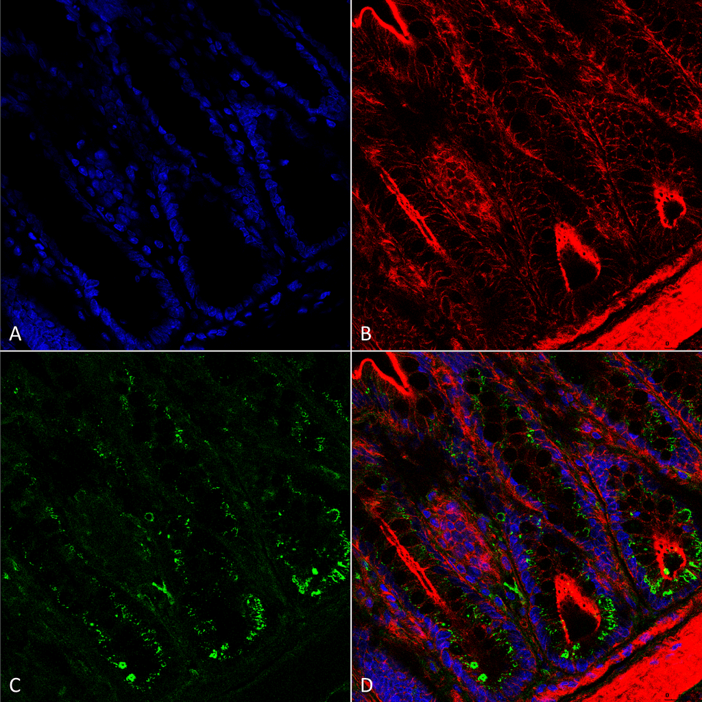 <p>Immunohistochemistry analysis using Mouse Anti-O-GalNAc Monoclonal Antibody, Clone 9B9 (SMC-503). Tissue: colon. Species: Mouse. Fixation: Formalin fixed, paraffin embedded. Primary Antibody: Mouse Anti-O-GalNAc Monoclonal Antibody (SMC-503) at 1:25 for 1 hour at RT. Secondary Antibody: Goat Anti-Mouse: Alexa Fluor 488. Counterstain: Actin-binding Phalloidin-Alexa Fluor 633; DAPI (blue) nuclear stain. Magnification: 63X. (A) DAPI (blue) nuclear stain. (B) Phalloidin Alexa Fluor 633 F-Actin stain. (C) O-GalNAc Antibody (D) Composite.</p>
