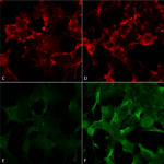 SMC-504_Acrolein_Antibody_2H2_ICC-IF_Human_Embryonic-kidney-cells-HEK293_Composite_1.png