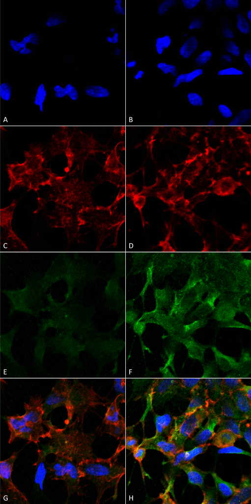 <p>Immunocytochemistry/Immunofluorescence analysis using Mouse Anti-Acrolein Monoclonal Antibody, Clone 2H2 (SMC-504). Tissue: Embryonic kidney epithelial cell line (HEK293). Species: Human. Fixation: 5% Formaldehyde for 5 min. Primary Antibody: Mouse Anti-Acrolein Monoclonal Antibody (SMC-504) at 1:50 for 30-60 min at RT. Secondary Antibody: Goat Anti-Mouse Alexa Fluor 488 at 1:1500 for 30-60 min at RT. Counterstain: Phalloidin Alexa Fluor 633 F-Actin stain; DAPI (blue) nuclear stain at 1:250, 1:50000 for 30-60 min at RT. Magnification: 20X (2X Zoom). (A,C,E,G) – Untreated. (B,D,F,H) – Cells cultured overnight with 50 µM H2O2. (A,B) DAPI (blue) nuclear stain. (C,D) Phalloidin Alexa Fluor 633 F-Actin stain. (E,F) Acrolein Antibody. (G,H) Composite. Courtesy of: Dr. Robert Burke, University of Victoria.</p>

