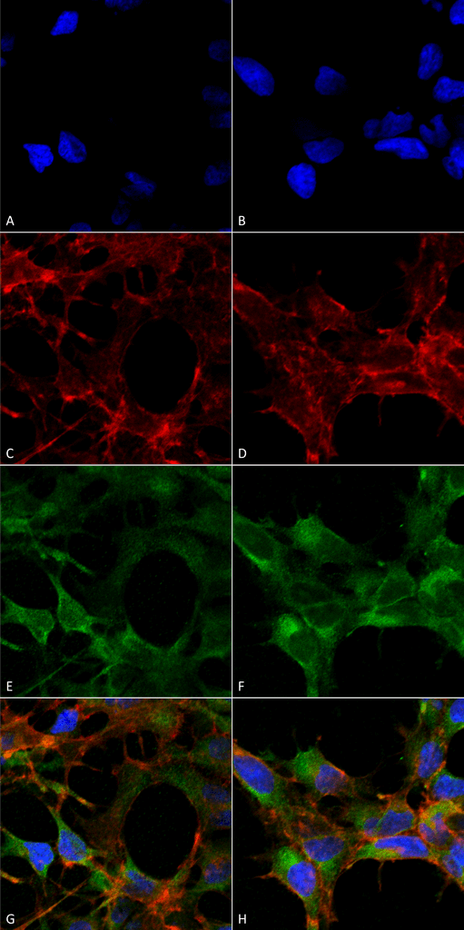 <p>Immunocytochemistry/Immunofluorescence analysis using Mouse Anti-Acrolein Monoclonal Antibody, Clone 10A10 (SMC-505). Tissue: Embryonic kidney epithelial cell line (HEK293). Species: Human. Fixation: 5% Formaldehyde for 5 min. Primary Antibody: Mouse Anti-Acrolein Monoclonal Antibody (SMC-505) at 1:50 for 30-60 min at RT. Secondary Antibody: Goat Anti-Mouse Alexa Fluor 488 at 1:1500 for 30-60 min at RT. Counterstain: Phalloidin Alexa Fluor 633 F-Actin stain; DAPI (blue) nuclear stain at 1:250, 1:50000 for 30-60 min at RT. Magnification: 20X (2X Zoom). (A,C,E,G) – Untreated. (B,D,F,H) – Cells cultured overnight with 50 µM H2O2. (A,B) DAPI (blue) nuclear stain. (C,D) Phalloidin Alexa Fluor 633 F-Actin stain. (E,F) Acrolein Antibody. (G,H) Composite. Courtesy of: Dr. Robert Burke, University of Victoria.</p>
