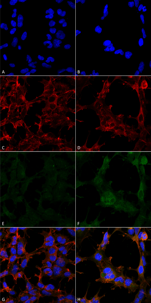 <p>Immunocytochemistry/Immunofluorescence analysis using Mouse Anti-Hexanoyl-Lysine adduct Monoclonal Antibody, Clone 5D9 (SMC-508). Tissue: Embryonic kidney epithelial cell line (HEK293). Species: Human. Fixation: 5% Formaldehyde for 5 min. Primary Antibody: Mouse Anti-Hexanoyl-Lysine adduct Monoclonal Antibody (SMC-508) at 1:50 for 30-60 min at RT. Secondary Antibody: Goat Anti-Mouse Alexa Fluor 488 at 1:1500 for 30-60 min at RT. Counterstain: Phalloidin Alexa Fluor 633 F-Actin stain; DAPI (blue) nuclear stain at 1:250, 1:50000 for 30-60 min at RT. Magnification: 20X (2X Zoom). (A,C,E,G) – Untreated. (B,D,F,H) – Cells cultured overnight with 50 µM H2O2. (A,B) DAPI (blue) nuclear stain. (C,D) Phalloidin Alexa Fluor 633 F-Actin stain. (E,F) Hexanoyl-Lysine adduct Antibody. (G,H) Composite. Courtesy of: Dr. Robert Burke, University of Victoria.</p>

