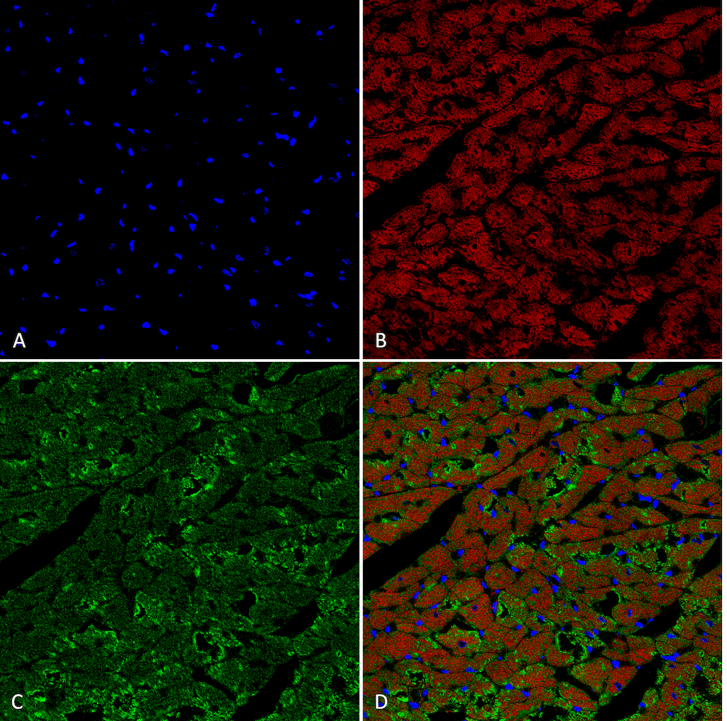 <p>Immunohistochemistry analysis using Mouse Anti-Hexanoyl-Lysine adduct Monoclonal Antibody, Clone 5D9 (SMC-508). Tissue: Heart. Species: Rat. Fixation: Formalin fixed, paraffin embedded. Primary Antibody: Mouse Anti-Hexanoyl-Lysine adduct Monoclonal Antibody (SMC-508) at 1:25 for 1 hour at RT. Secondary Antibody: Goat Anti-Mouse IgG: Alexa Fluor 488. Counterstain: DAPI (blue) nuclear stain. Magnification: 63X. (A) DAPI (blue) nuclear stain. (B) Actin (C) Hexanoyl-Lysine adduct Antibody (D) Composite.</p>
