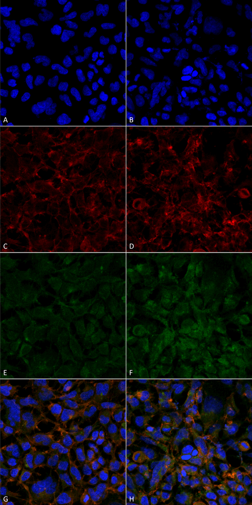 <p>Immunocytochemistry/Immunofluorescence analysis using Mouse Anti-Hexanoyl-Lysine adduct Monoclonal Antibody, Clone 5E8 (SMC-509). Tissue: Embryonic kidney epithelial cell line (HEK293). Species: Human. Fixation: 5% Formaldehyde for 5 min. Primary Antibody: Mouse Anti-Hexanoyl-Lysine adduct Monoclonal Antibody (SMC-509) at 1:50 for 30-60 min at RT. Secondary Antibody: Goat Anti-Mouse Alexa Fluor 488 at 1:1500 for 30-60 min at RT. Counterstain: Phalloidin Alexa Fluor 633 F-Actin stain; DAPI (blue) nuclear stain at 1:250, 1:50000 for 30-60 min at RT. Magnification: 20X (2X Zoom). (A,C,E,G) – Untreated. (B,D,F,H) – Cells cultured overnight with 50 µM H2O2. (A,B) DAPI (blue) nuclear stain. (C,D) Phalloidin Alexa Fluor 633 F-Actin stain. (E,F) Hexanoyl-Lysine adduct Antibody. (G,H) Composite. Courtesy of: Dr. Robert Burke, University of Victoria.</p>
