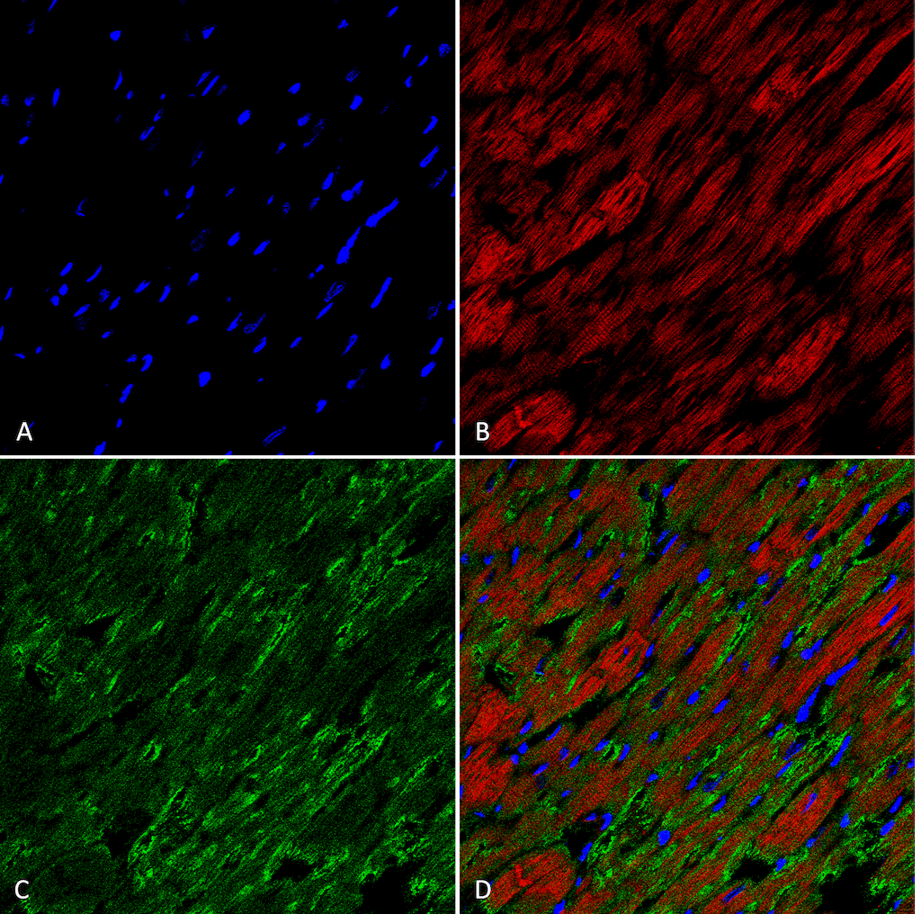 <p>Immunohistochemistry analysis using Mouse Anti-Hexanoyl-Lysine adduct Monoclonal Antibody, Clone 5E8 (SMC-509). Tissue: Heart. Species: Rat. Fixation: Formalin fixed, paraffin embedded. Primary Antibody: Mouse Anti-Hexanoyl-Lysine adduct Monoclonal Antibody (SMC-509) at 1:26 for 2 hour at RT. Secondary Antibody: Goat Anti-Mouse IgG: Alexa Fluor 489. Counterstain: DAPI (blue) nuclear stain. Magnification: 63X. (A) DAPI (blue) nuclear stain. (B) Actin (C) Hexanoyl-Lysine adduct Antibody (D) Composite.</p>
