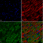 SMC-509_Hexanoyl-Lysine-adduct_Antibody_5E8_IHC_Rat_Heart_1.png