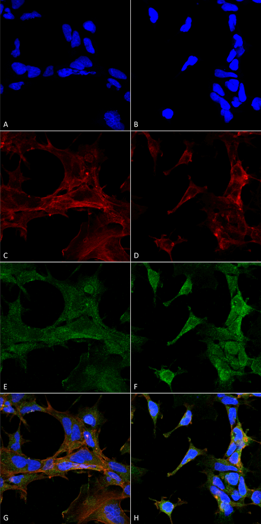 <p>Immunocytochemistry/Immunofluorescence analysis using Mouse Anti-4-Hydroxy-2-hexenal Monoclonal Antibody, Clone 6F10 (SMC-510). Tissue: Embryonic kidney epithelial cell line (HEK293). Species: Human. Fixation: 5% Formaldehyde for 5 min. Primary Antibody: Mouse Anti-4-Hydroxy-2-hexenal Monoclonal Antibody (SMC-510) at 1:400 for 30-60 min at RT. Secondary Antibody: Goat Anti-Mouse Alexa Fluor 488 at 1:1500 for 30-60 min at RT. Counterstain: Phalloidin Alexa Fluor 633 F-Actin stain; DAPI (blue) nuclear stain at 1:250, 1:50000 for 30-60 min at RT. Magnification: 20X (2X Zoom). (A,C,E,G) – Untreated. (B,D,F,H) – Cells cultured overnight with 50 µM H2O2. (A,B) DAPI (blue) nuclear stain. (C,D) Phalloidin Alexa Fluor 633 F-Actin stain. (E,F) 4-Hydroxy-2-hexenal Antibody. (G,H) Composite. Courtesy of: Dr. Robert Burke, University of Victoria.</p>
