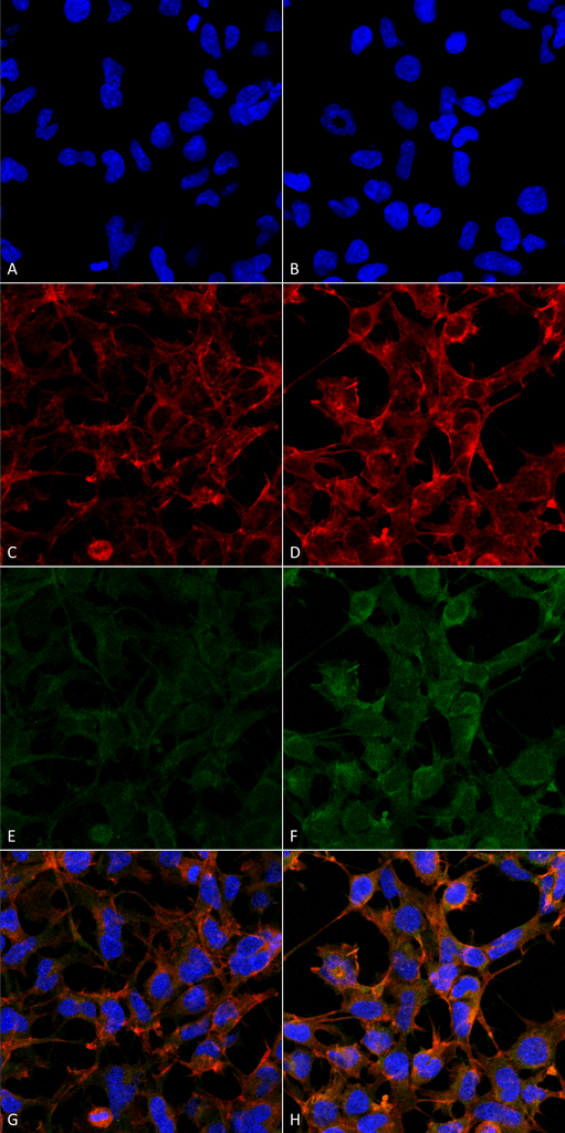 <p>Immunocytochemistry/Immunofluorescence analysis using Mouse Anti-4-Hydroxynonenal Monoclonal Antibody, Clone 12F7 (SMC-511). Tissue: Embryonic kidney epithelial cell line (HEK293). Species: Human. Fixation: 5% Formaldehyde for 5 min. Primary Antibody: Mouse Anti-4-Hydroxynonenal Monoclonal Antibody (SMC-511) at 1:50 for 30-60 min at RT. Secondary Antibody: Goat Anti-Mouse Alexa Fluor 488 at 1:1500 for 30-60 min at RT. Counterstain: Phalloidin Alexa Fluor 633 F-Actin stain; DAPI (blue) nuclear stain at 1:250, 1:50000 for 30-60 min at RT. Magnification: 20X (2X Zoom). (A,C,E,G) – Untreated. (B,D,F,H) – Cells cultured overnight with 50 µM H2O2. (A,B) DAPI (blue) nuclear stain. (C,D) Phalloidin Alexa Fluor 633 F-Actin stain. (E,F) 4-Hydroxynonenal Antibody. (G,H) Composite. Courtesy of: Dr. Robert Burke, University of Victoria.</p>
