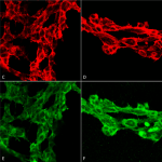 SMC-512_7-Ketocholesterol_Antibody_7E1_ICC-IF_Human_Embryonic-kidney-cells-HEK293_Composite_1.png